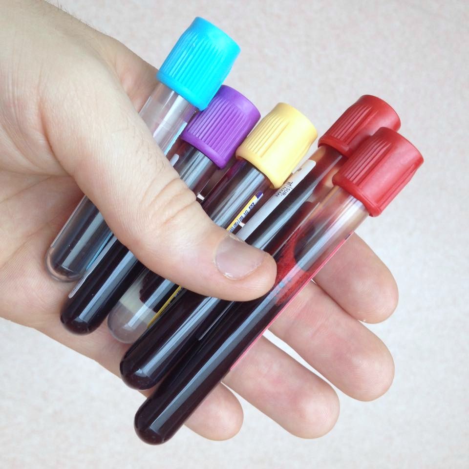 Probleme bei der Ermittlung der Schilddrüsenfunktion durch Bluttests